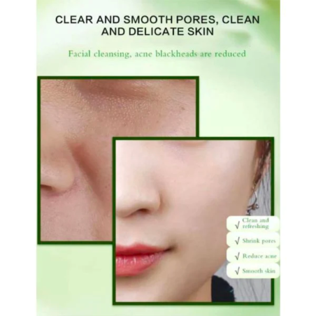 ALOE VERA IHONHOITOSETTI