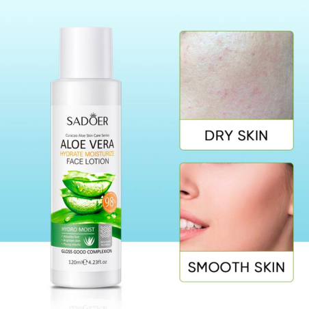 ALOE VERA -LOTION KOSTEUSEMULSIO