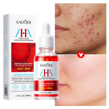 HEDELMÄHAPPOSEERUMI AHA + BHA