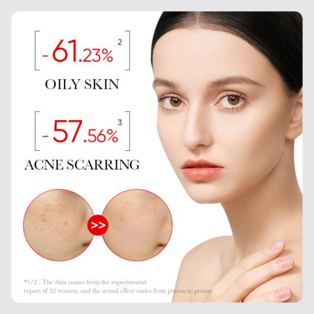 HEDELMÄHAPPOSEERUMI AHA + BHA